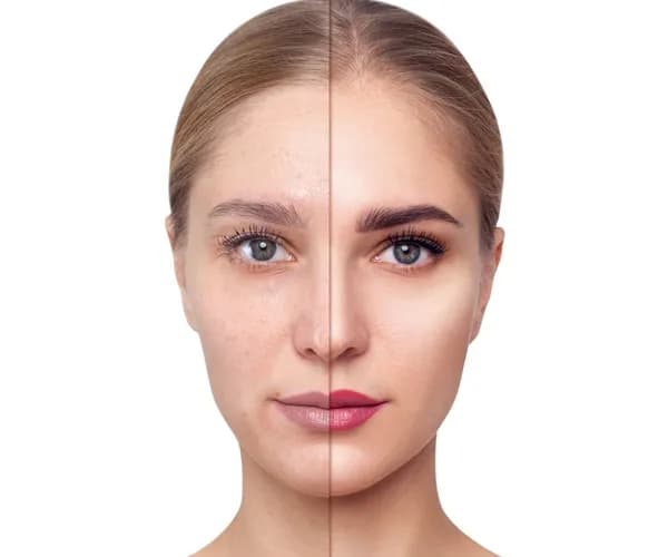 Anti Aging Treatment Clinic in Delhi