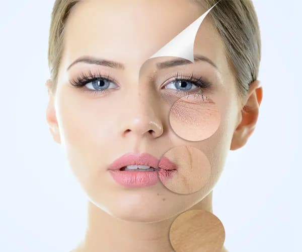 Best Anti Wrinkle Treatment Clinic in Delhi