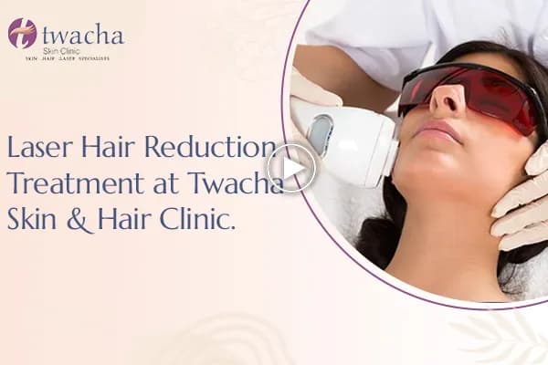 What to Know Before Laser Hair Removal