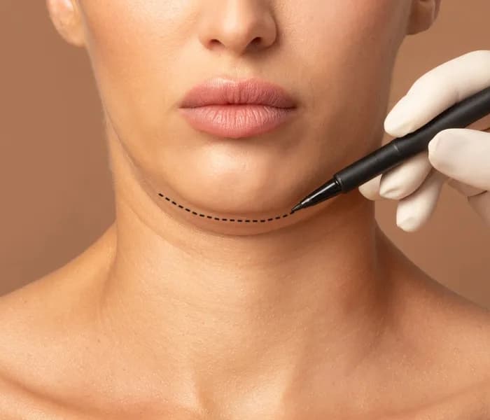 Double Chin Reduction Treatment Clinic in Delhi