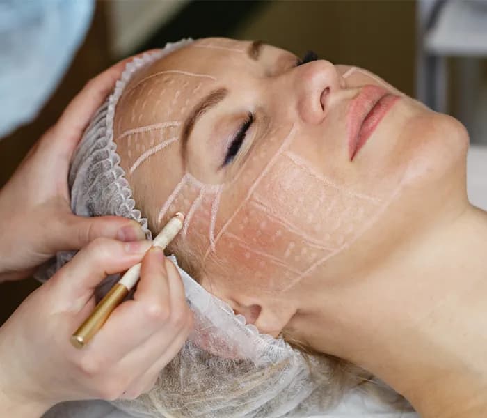 Face Lift Treatment Clinic in Delhi