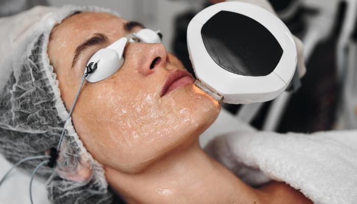 (IPL) Intense Pulsed Light Therapy in Delhi