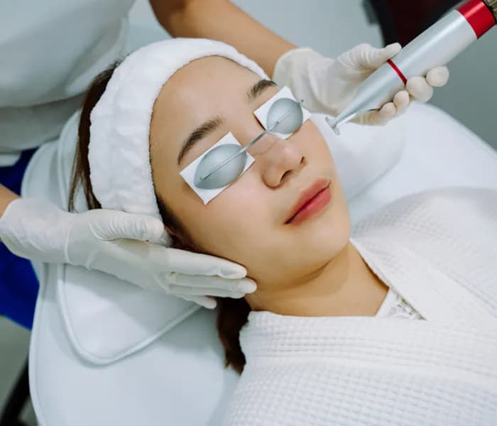Q Switch Laser Treatment Clinic in Delhi