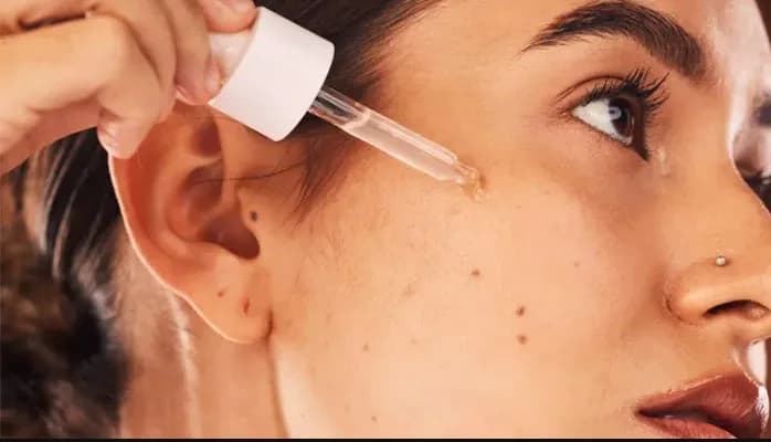 Blackheads, Whiteheads & Cysts: Identify Your Acne Type