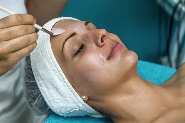 Chemical Peel Treatment in Delhi