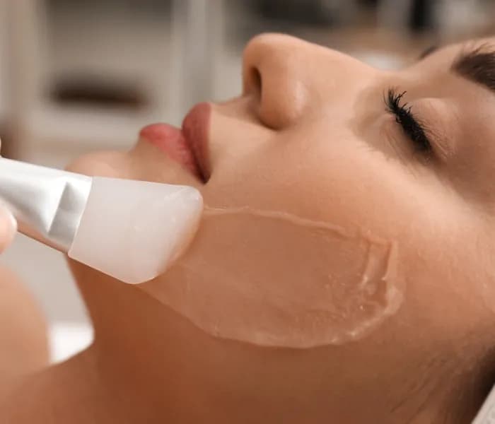 Chemical Peel Treatment Clinic in Delhi