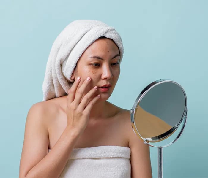 Pigmentation Treatment Guide for Delhi Skin