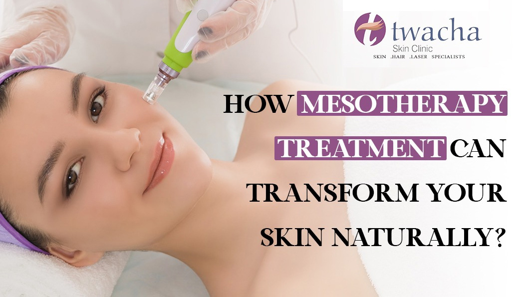 How Mesotherapy Treatment Can Transform Your Skin Naturally?